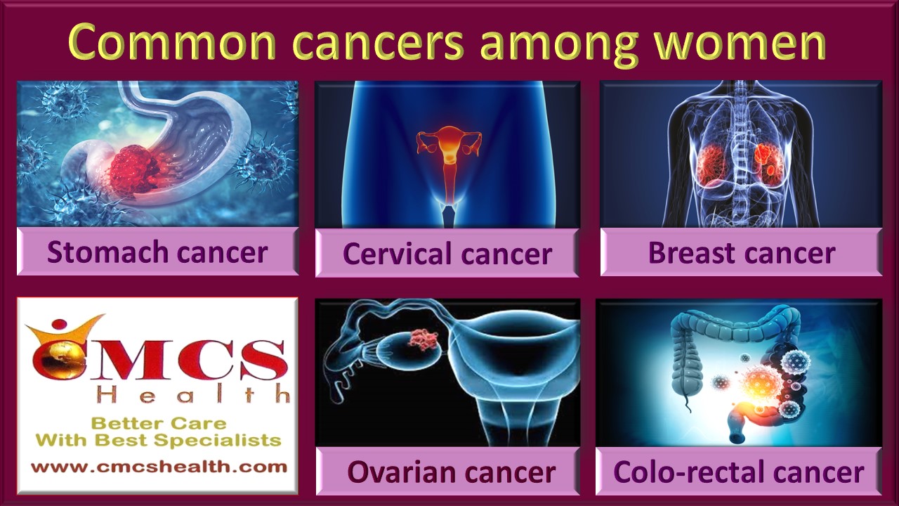 Common cancer among women.