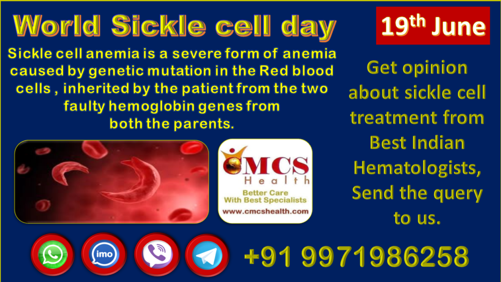 Sickle cell disease treatment in India | BMT