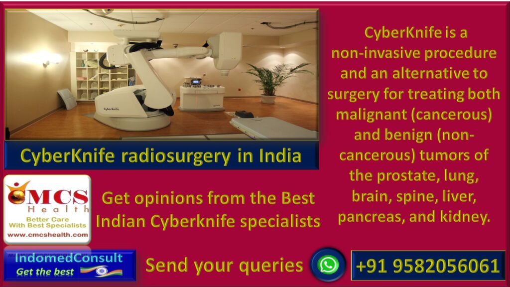 Best  CyberKnife treatments in India for tumors of brain,prostate , lung, liver, spine,pancreas ,kidneys and trigeminal neuralgia.