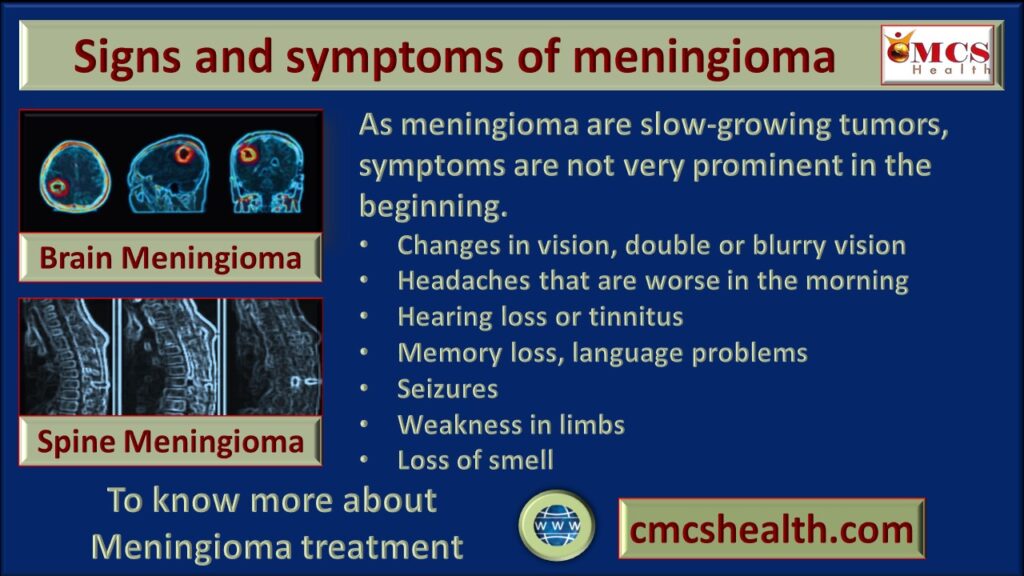 Symptoms of meningioma .