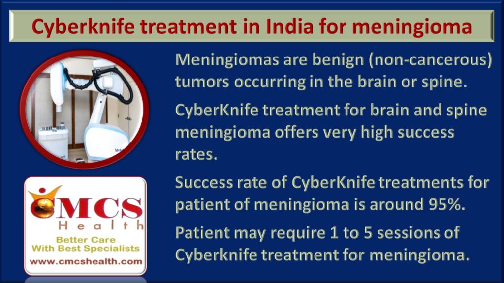 Cyberknife treatment for meningioma - CMCS health.