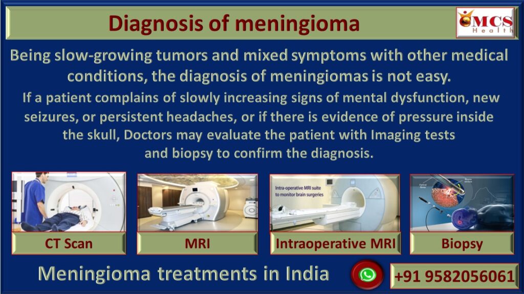 Meningioma diagnosis - CMCS Health.