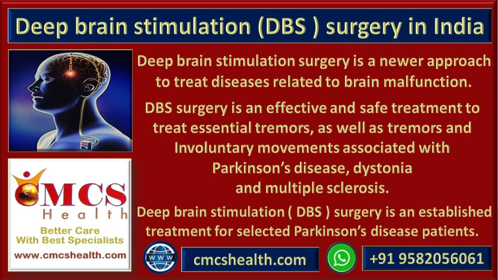 Deep brain stimulation (DBS) surgery in India - CMCS Health. 
