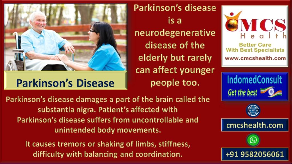 Deep brain stimulation surgery(DBS) in India for Parkinson's disease.