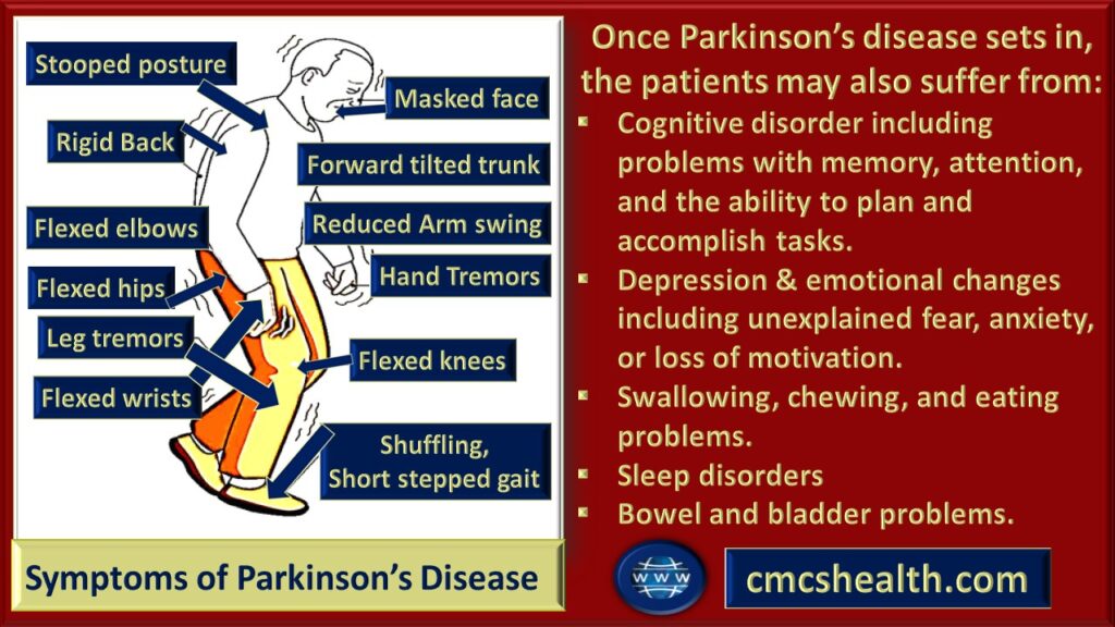 Symptoms of Parkinson's disease - Deep brain stimulation in India-CMCS Health.
