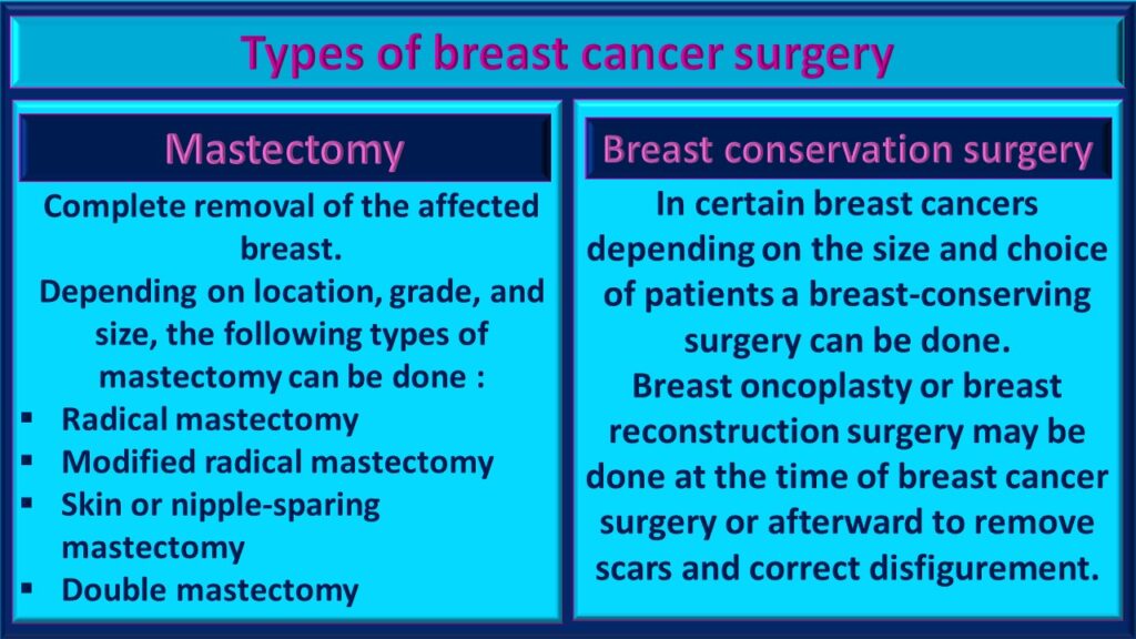 Breast cancer surgery in India - CMCS health.