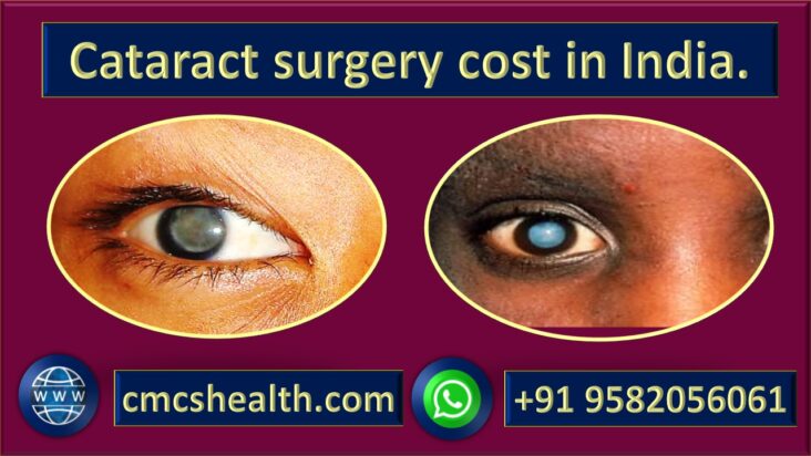 Cataract surgery cost in India - Best Intraocular lens CMCS health.